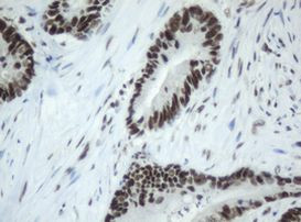 SF3A1 Antibody in Immunohistochemistry (Paraffin) (IHC (P))