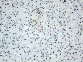 SF3A1 Antibody in Immunohistochemistry (Paraffin) (IHC (P))