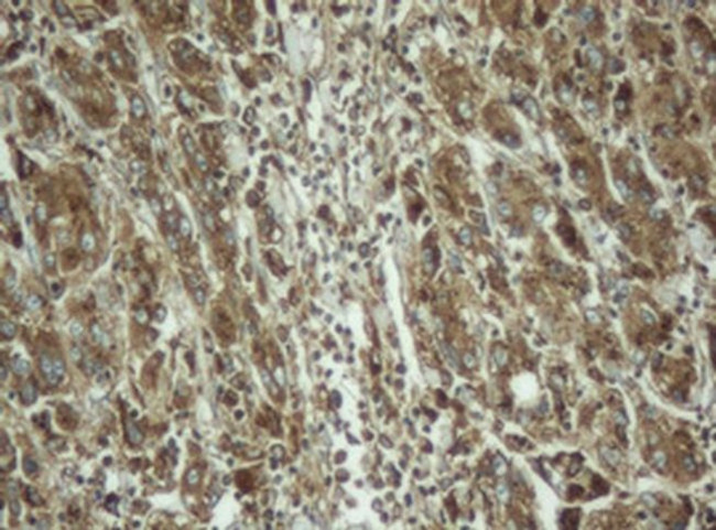 PPT1 Antibody in Immunohistochemistry (Paraffin) (IHC (P))