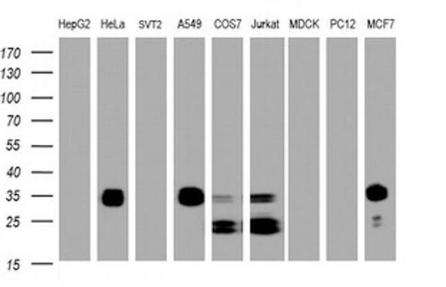 PPT1 Antibody in Western Blot (WB)