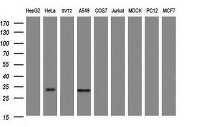 ING2 Antibody in Western Blot (WB)