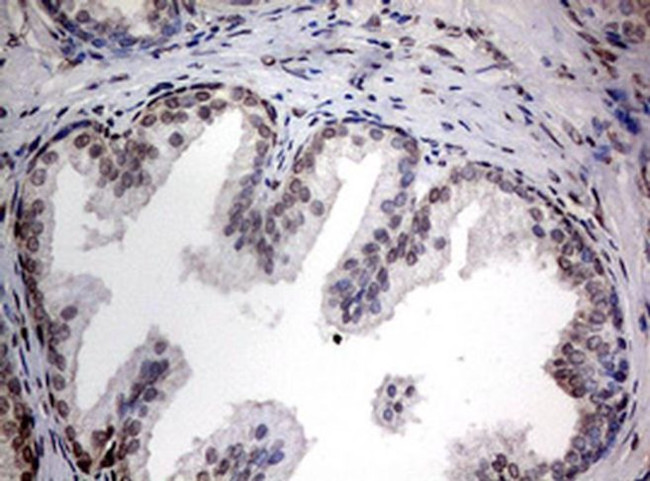 TIA-1 Antibody in Immunohistochemistry (Paraffin) (IHC (P))