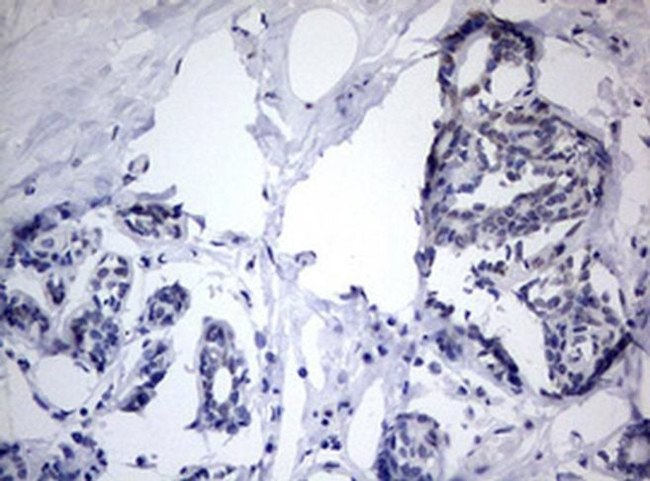 TIA-1 Antibody in Immunohistochemistry (Paraffin) (IHC (P))