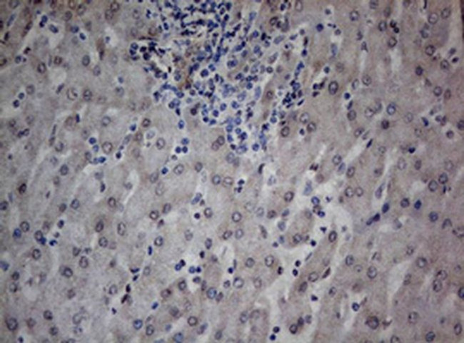 TIA-1 Antibody in Immunohistochemistry (Paraffin) (IHC (P))