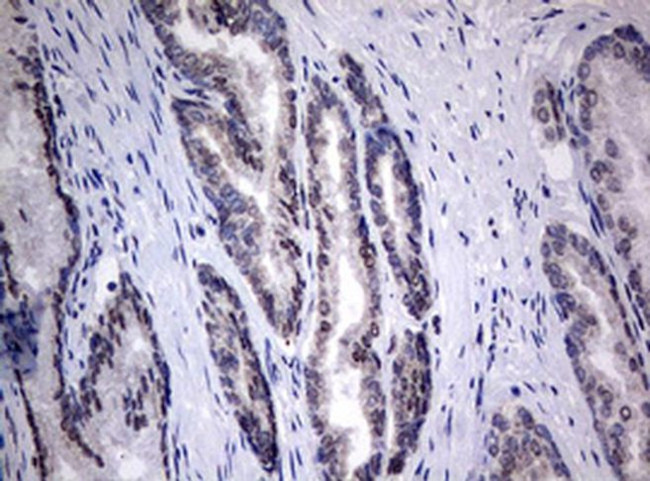 TIA-1 Antibody in Immunohistochemistry (Paraffin) (IHC (P))