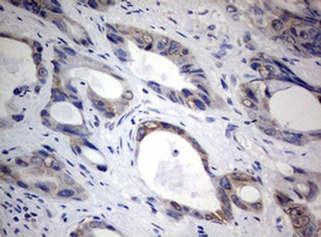 TIA-1 Antibody in Immunohistochemistry (Paraffin) (IHC (P))