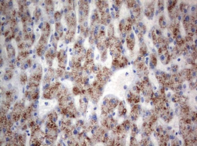 TIA-1 Antibody in Immunohistochemistry (Paraffin) (IHC (P))