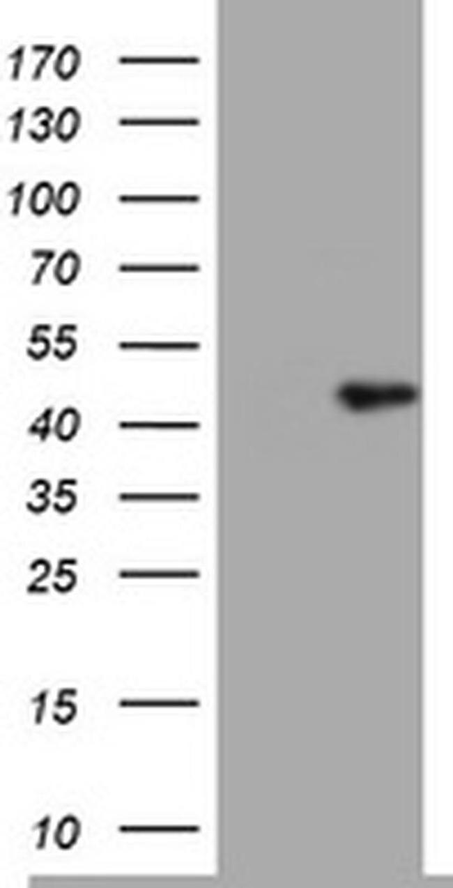 TIA-1 Antibody in Western Blot (WB)