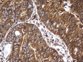 SERBP1 Antibody in Immunohistochemistry (Paraffin) (IHC (P))