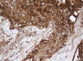 SERBP1 Antibody in Immunohistochemistry (Paraffin) (IHC (P))