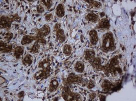 SERBP1 Antibody in Immunohistochemistry (Paraffin) (IHC (P))