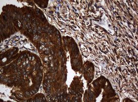 SERBP1 Antibody in Immunohistochemistry (Paraffin) (IHC (P))