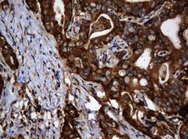 SERBP1 Antibody in Immunohistochemistry (Paraffin) (IHC (P))