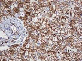 SERBP1 Antibody in Immunohistochemistry (Paraffin) (IHC (P))