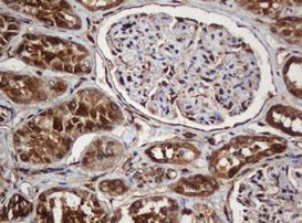 SERBP1 Antibody in Immunohistochemistry (Paraffin) (IHC (P))