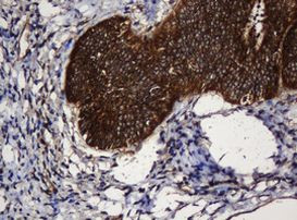 SERBP1 Antibody in Immunohistochemistry (Paraffin) (IHC (P))