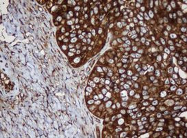 SERBP1 Antibody in Immunohistochemistry (Paraffin) (IHC (P))