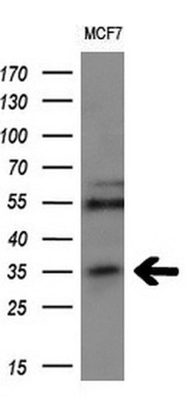 MAGEA3 Antibody in Western Blot (WB)