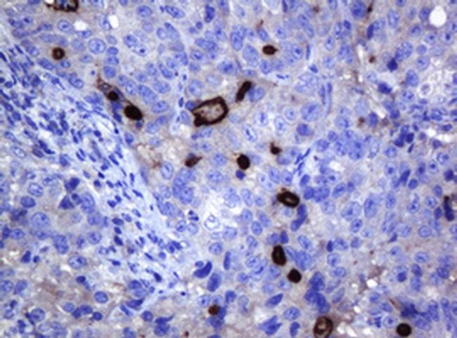 MAGEA3 Antibody in Immunohistochemistry (Paraffin) (IHC (P))