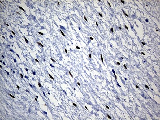 SATB2 Antibody in Immunohistochemistry (Paraffin) (IHC (P))