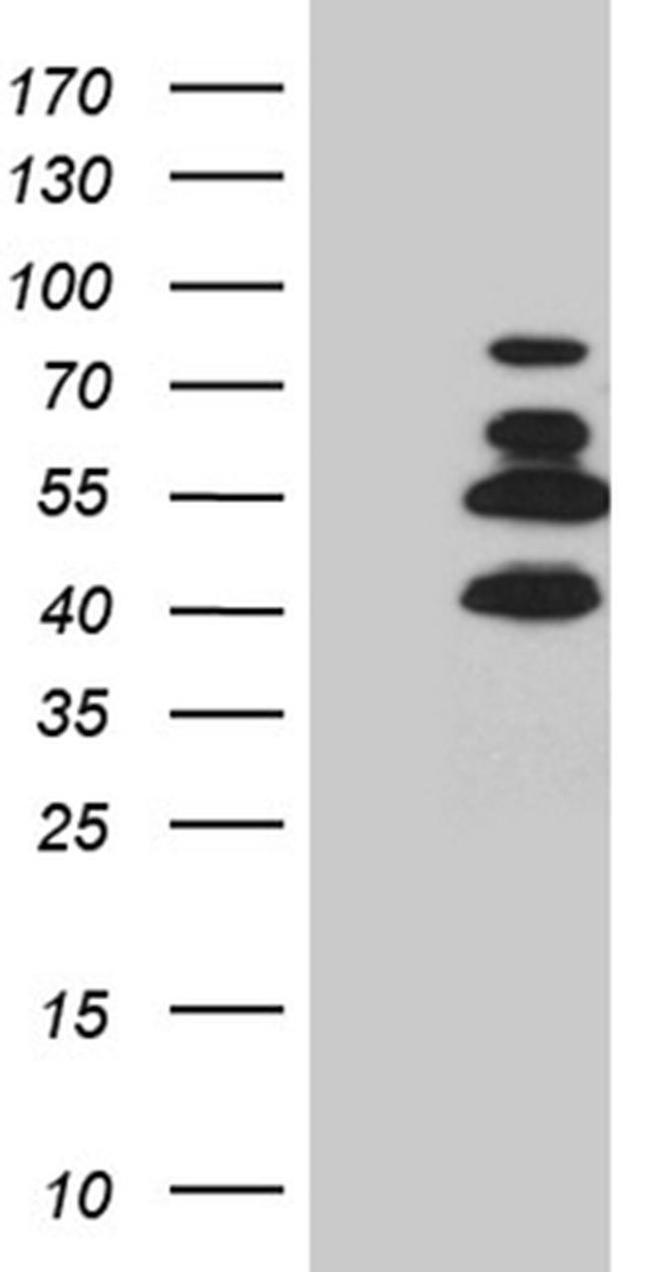 SATB2 Antibody in Western Blot (WB)