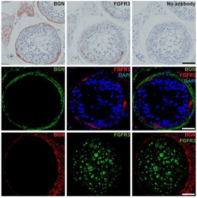 FGFR3 Antibody in Immunohistochemistry (IHC)