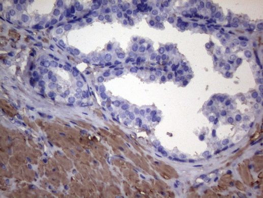 VEGFC Antibody in Immunohistochemistry (Paraffin) (IHC (P))