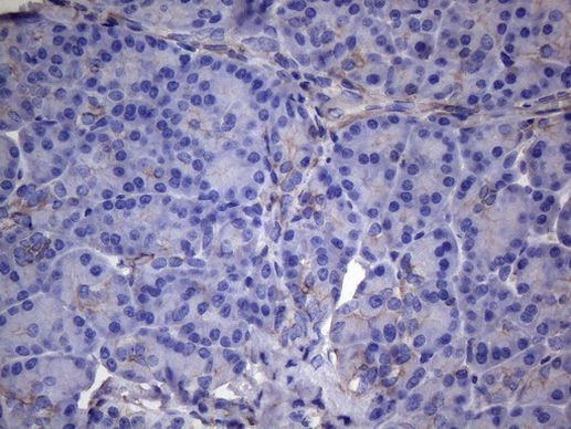 VEGFC Antibody in Immunohistochemistry (Paraffin) (IHC (P))