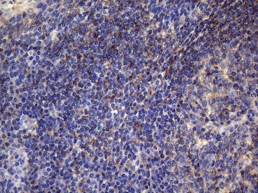 VEGFC Antibody in Immunohistochemistry (Paraffin) (IHC (P))