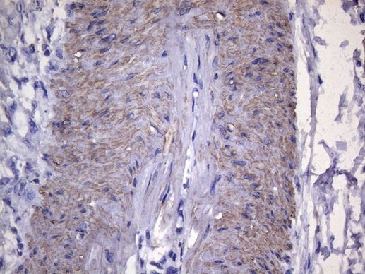 VEGFC Antibody in Immunohistochemistry (Paraffin) (IHC (P))