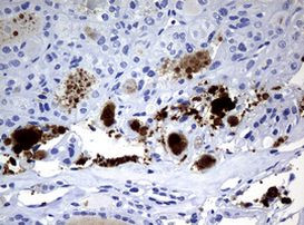 WFDC2 Antibody in Immunohistochemistry (Paraffin) (IHC (P))