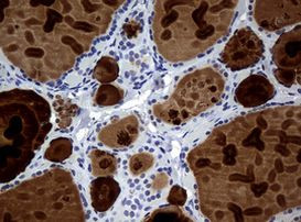 WFDC2 Antibody in Immunohistochemistry (Paraffin) (IHC (P))