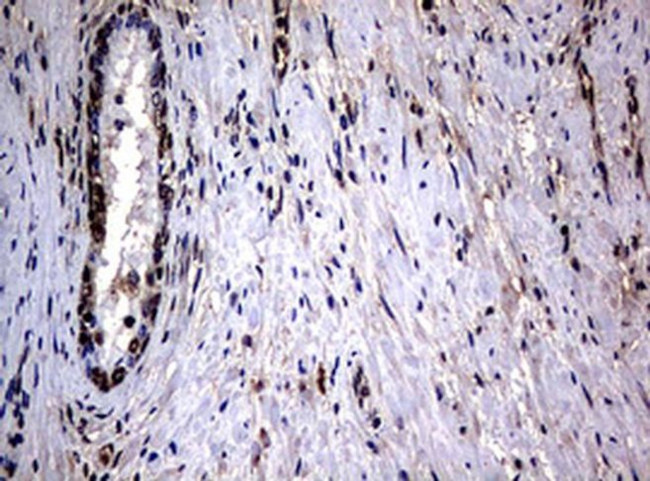 RASGRP3 Antibody in Immunohistochemistry (Paraffin) (IHC (P))