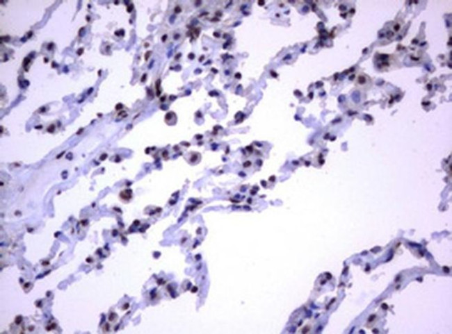 RASGRP3 Antibody in Immunohistochemistry (Paraffin) (IHC (P))