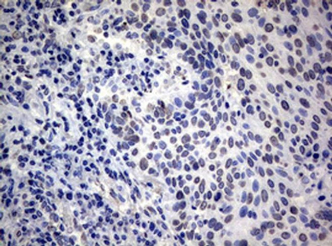 RASGRP3 Antibody in Immunohistochemistry (Paraffin) (IHC (P))