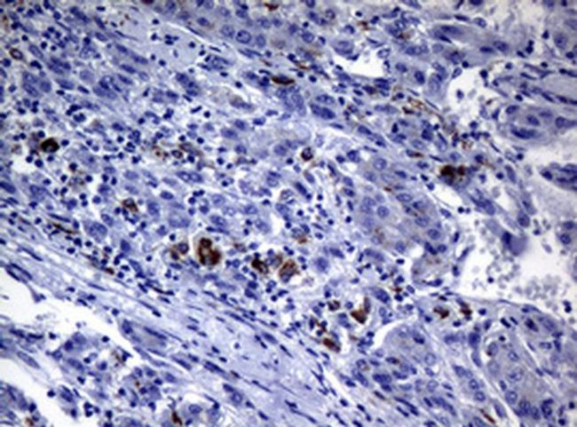 POLI Antibody in Immunohistochemistry (Paraffin) (IHC (P))