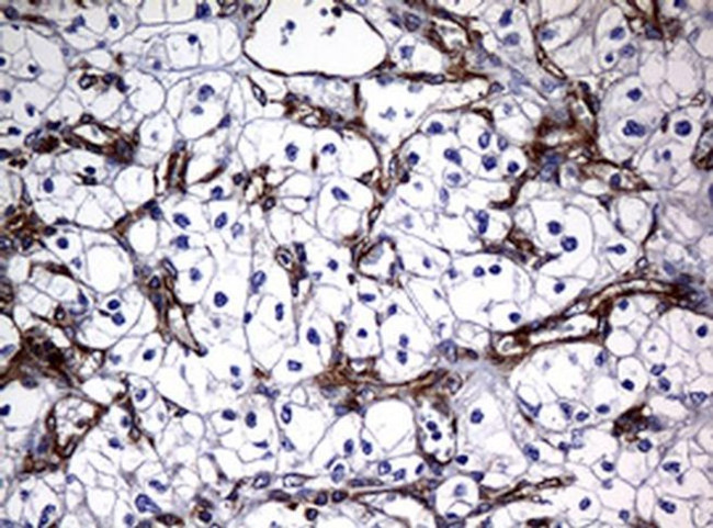 RASGRP3 Antibody in Immunohistochemistry (Paraffin) (IHC (P))