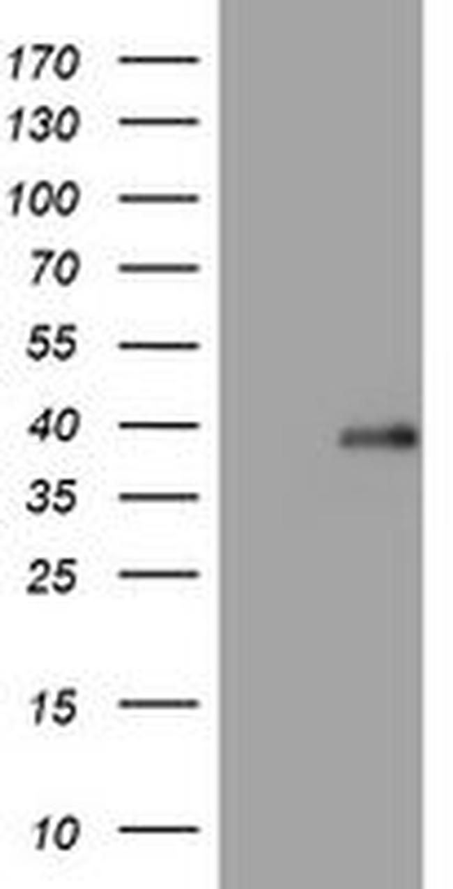 PIK3C2A Antibody in Western Blot (WB)