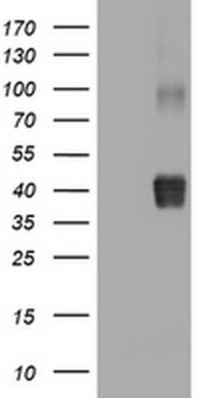 NEU1 Antibody in Western Blot (WB)