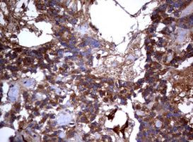 PIK3C2A Antibody in Immunohistochemistry (Paraffin) (IHC (P))