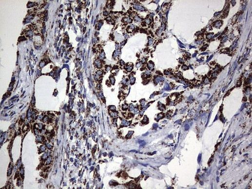 PIK3CD Antibody in Immunohistochemistry (Paraffin) (IHC (P))