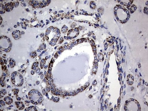 PIK3CD Antibody in Immunohistochemistry (Paraffin) (IHC (P))