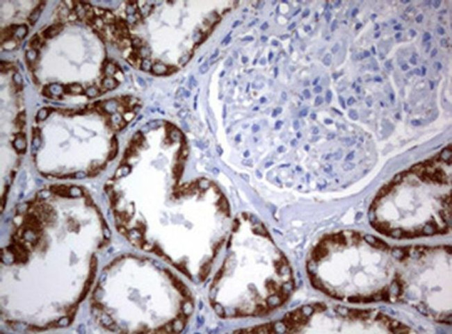 PIK3CD Antibody in Immunohistochemistry (Paraffin) (IHC (P))