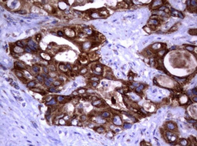 PIK3CD Antibody in Immunohistochemistry (Paraffin) (IHC (P))