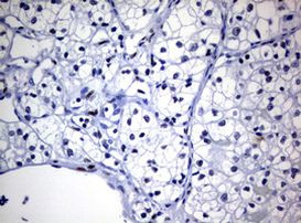 ZEB2 Antibody in Immunohistochemistry (Paraffin) (IHC (P))