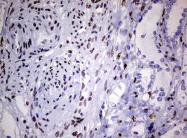 ZEB2 Antibody in Immunohistochemistry (Paraffin) (IHC (P))