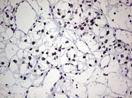 ZEB2 Antibody in Immunohistochemistry (Paraffin) (IHC (P))