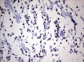 ZEB2 Antibody in Immunohistochemistry (Paraffin) (IHC (P))