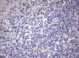 ZEB2 Antibody in Immunohistochemistry (Paraffin) (IHC (P))