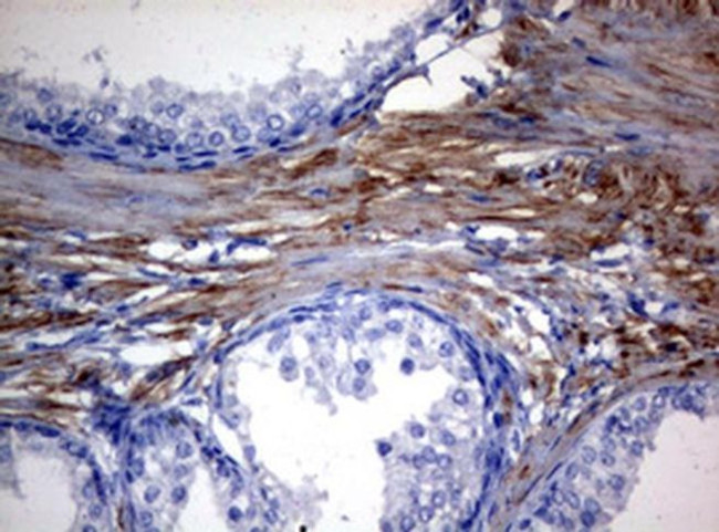 MFN1 Antibody in Immunohistochemistry (Paraffin) (IHC (P))